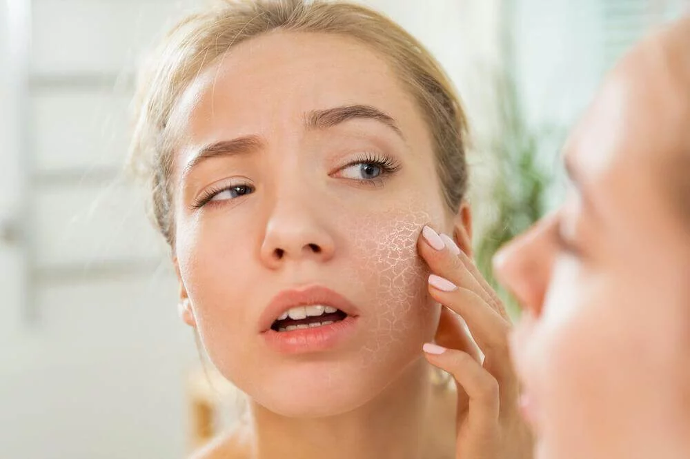 vitamins for dry skin